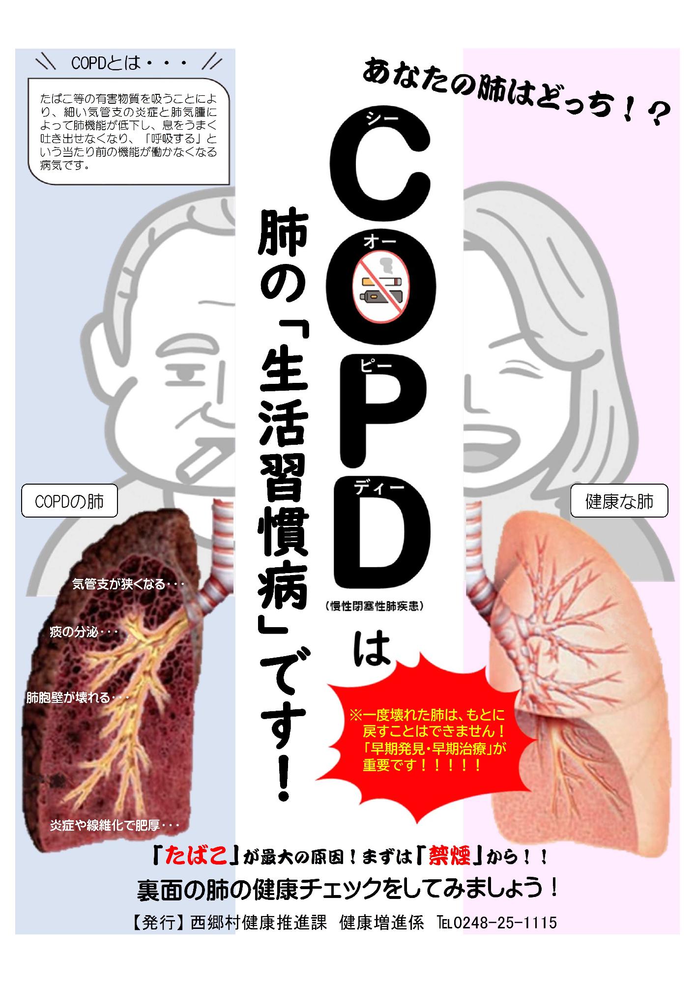 COPD(慢性閉塞性肺疾患)は肺の「生活習慣病」です!